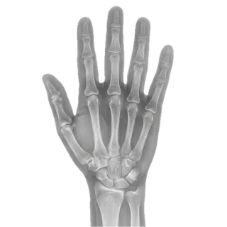 X-ray, a flash card photograph for children